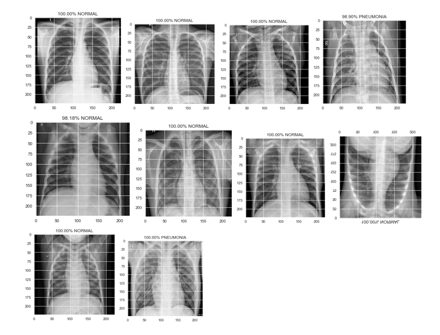 Fig: Visualizing the first 10 predictions of Chest X-rays